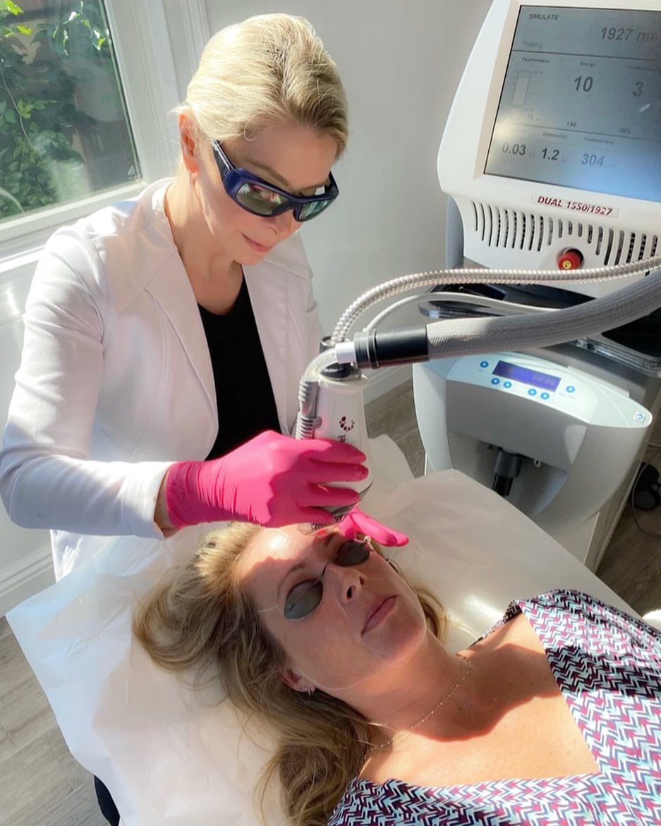 Fraxel Laser Used on Patient